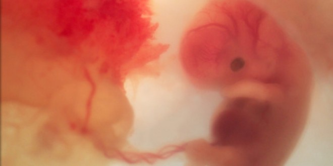 الكحول والحمل